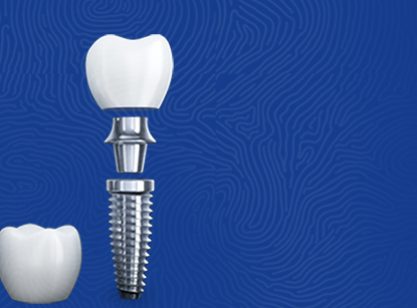 teeth straightening slide1