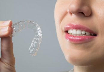 Invisalign Milton Keynes