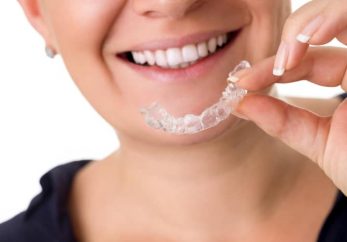 Invisalign teeth straightening in Milton Keynes