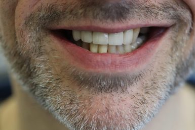After - Abacus Dental