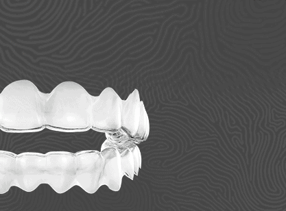 teeth straightening slide1