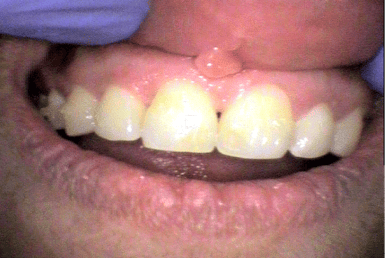 After - Abacus Dental