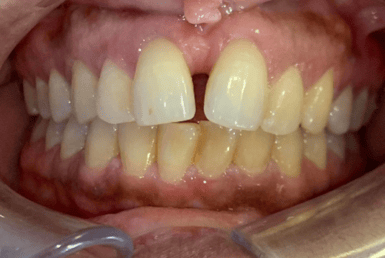 Before - Abacus Dental