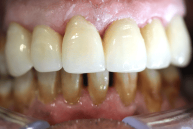 After - Abacus Dental