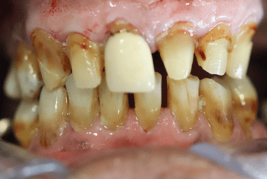 Before - Abacus Dental