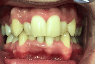 Before - Abacus Dental
