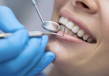 dental hygiene appointment milton keynes