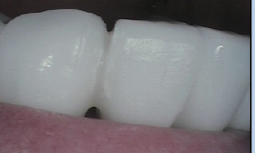 After -Abacus Dental