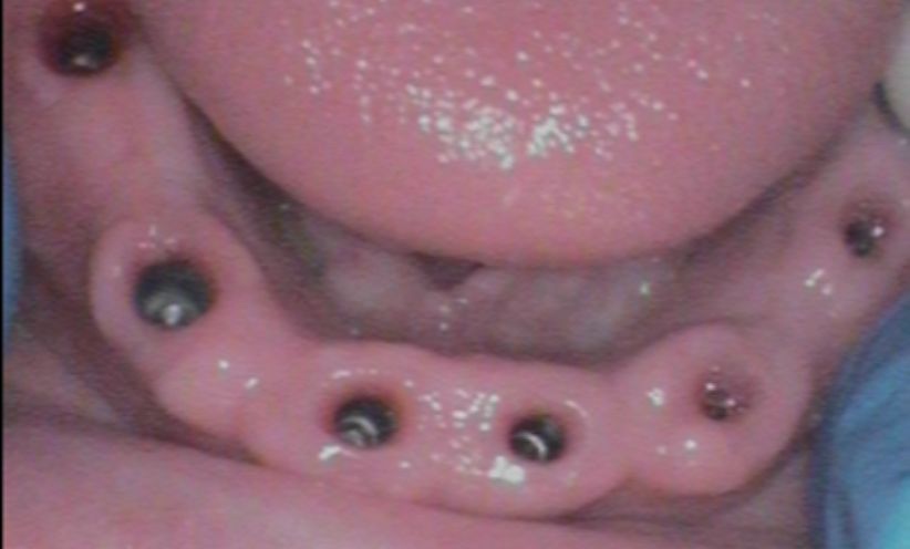 Before - Abacus Dental
