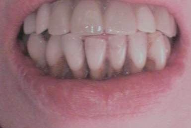 Before - Abacus Dental