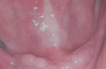 Before - Abacus Dental