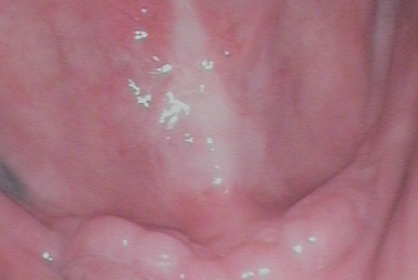 Before - Abacus Dental