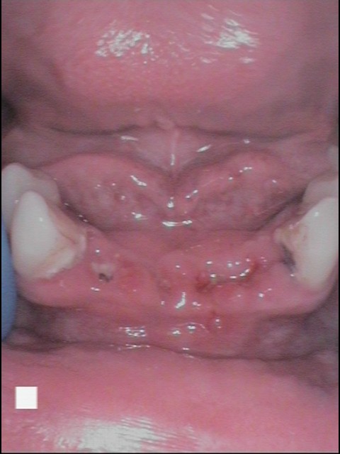 Before - Abacus Dental