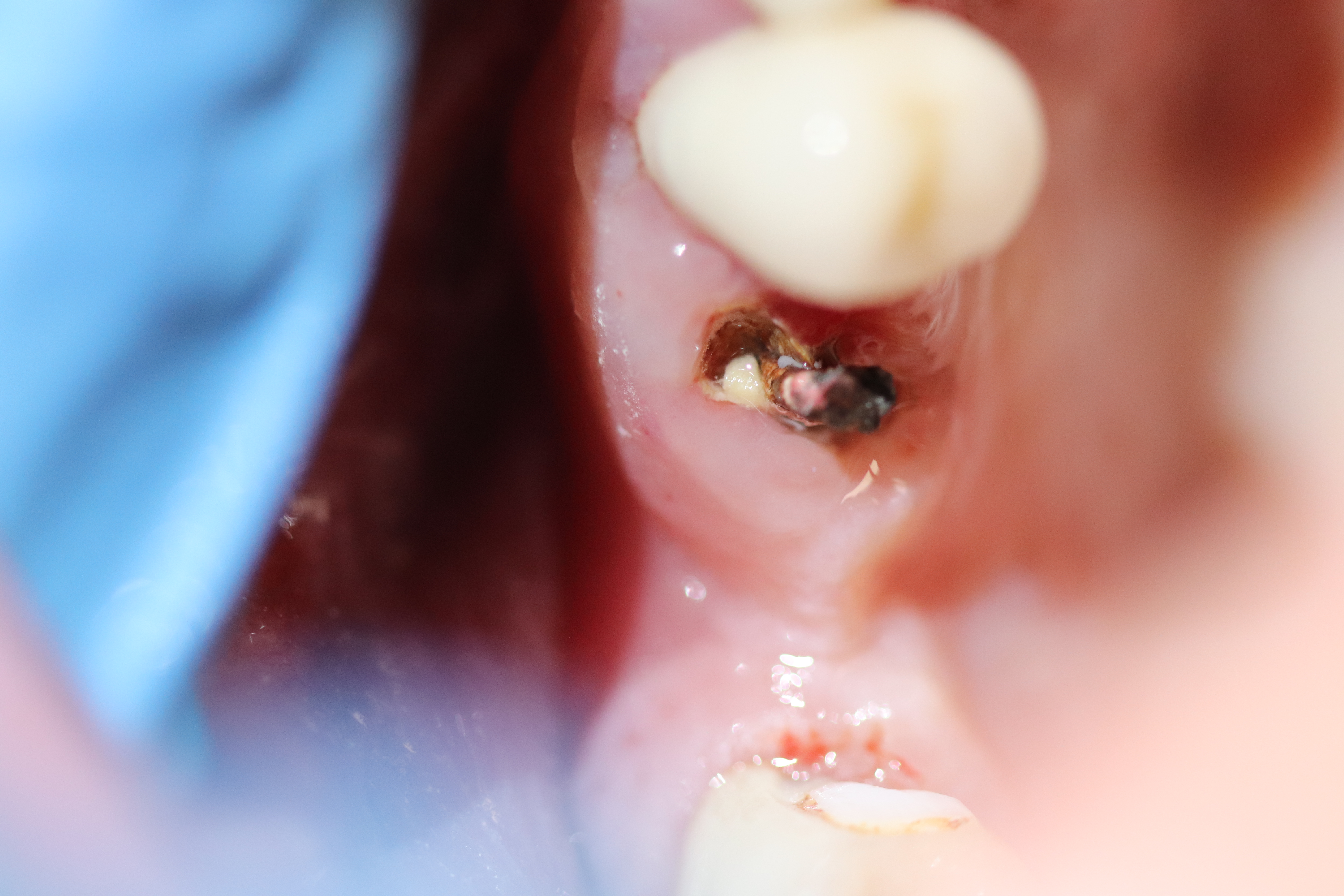 Before - Abacus Dental