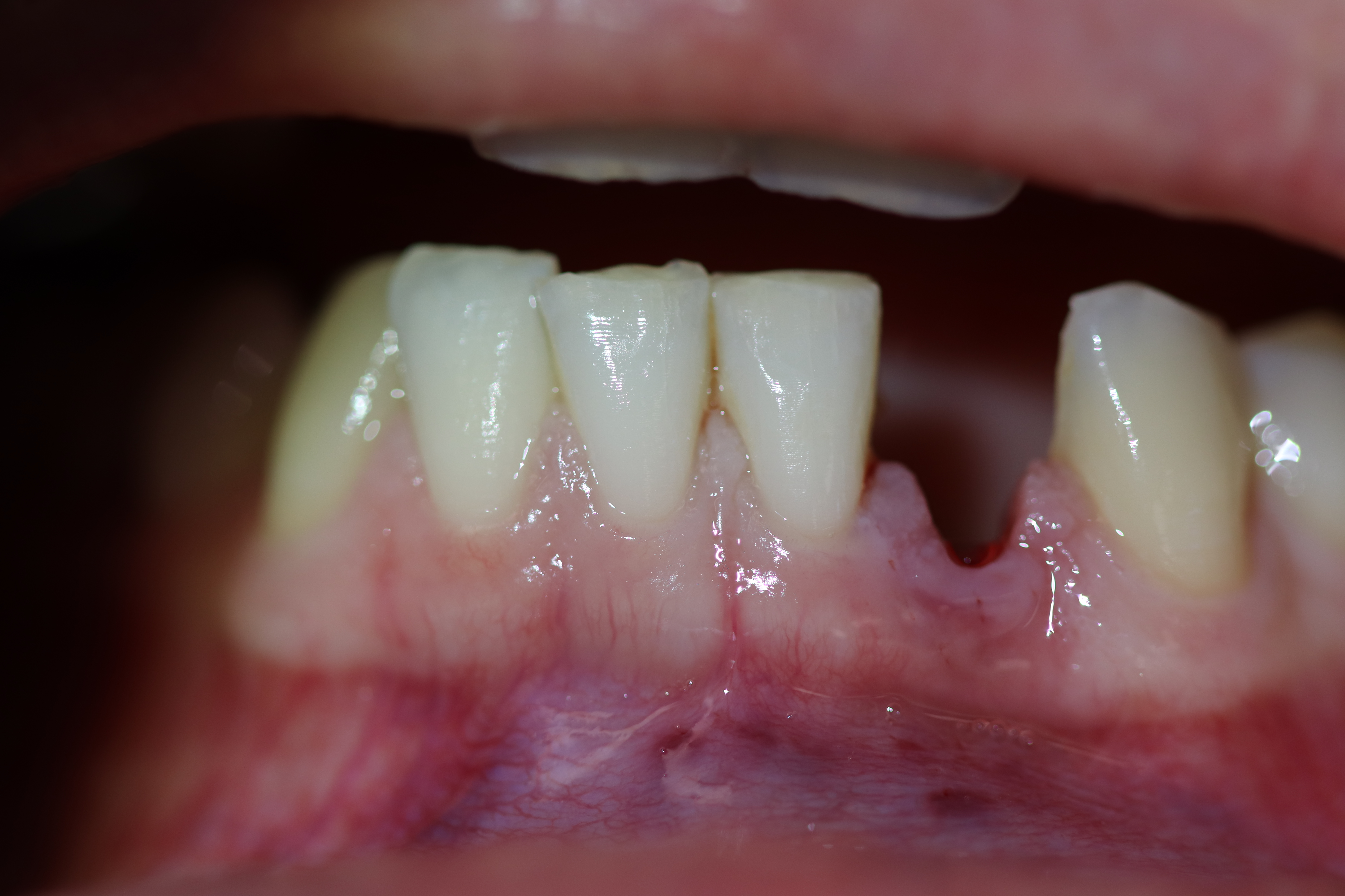 Before - Abacus Dental