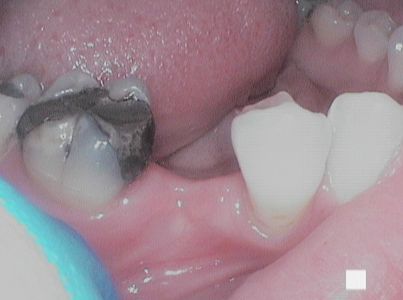 Before - Abacus Dental