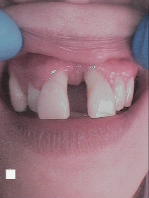Before - Abacus Dental