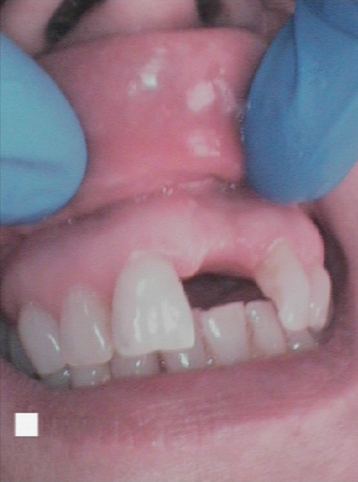 Before - Abacus Dental