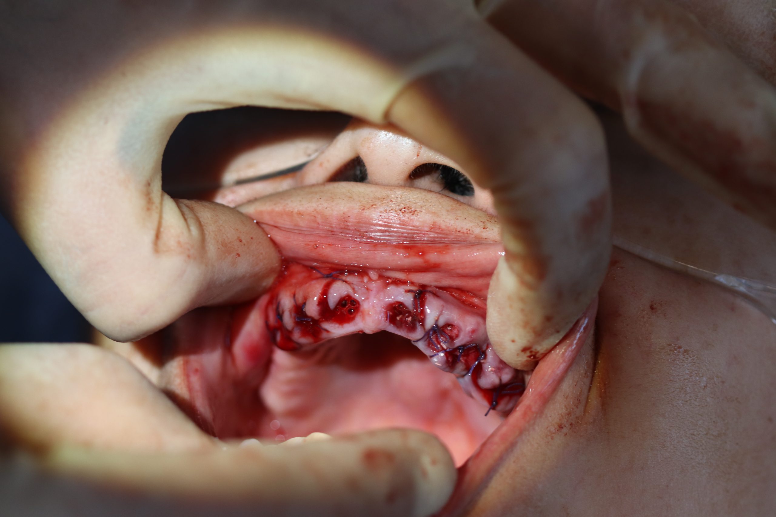 After -Abacus Dental