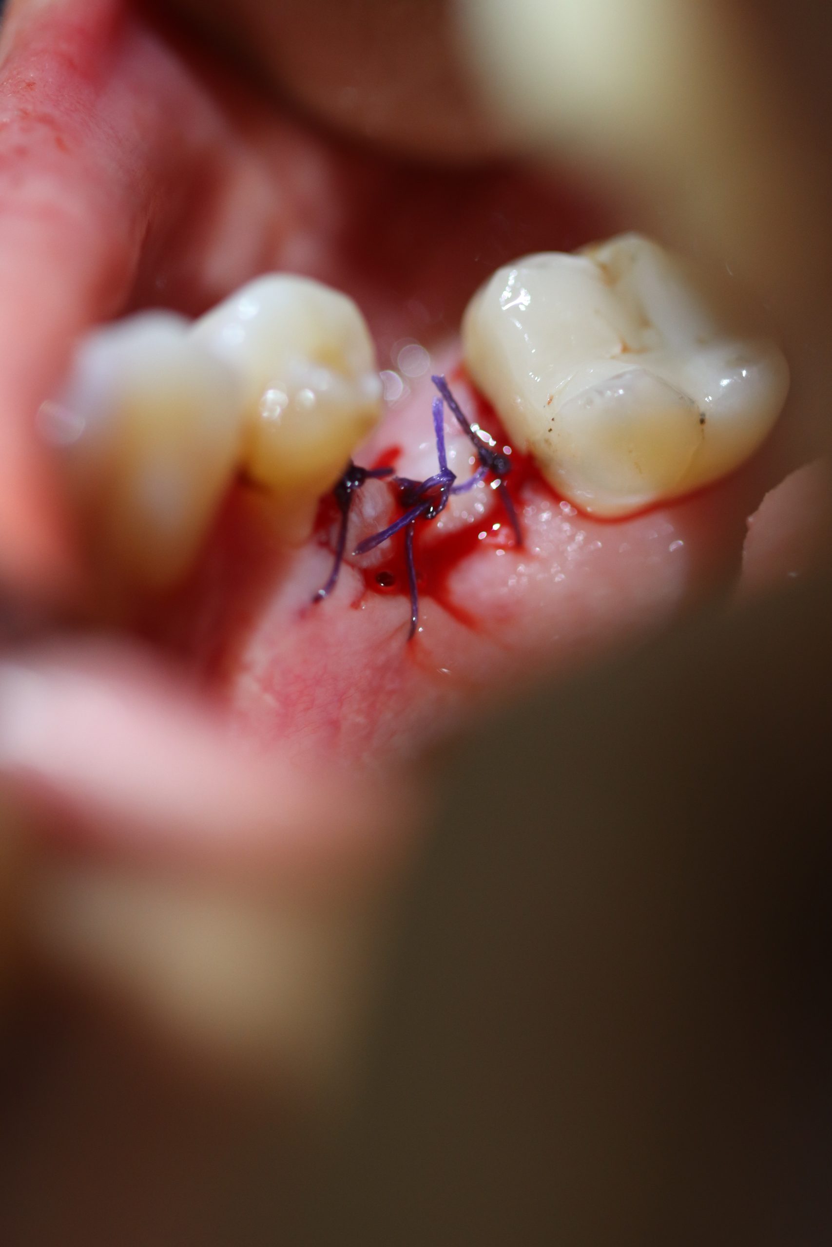 After -Abacus Dental