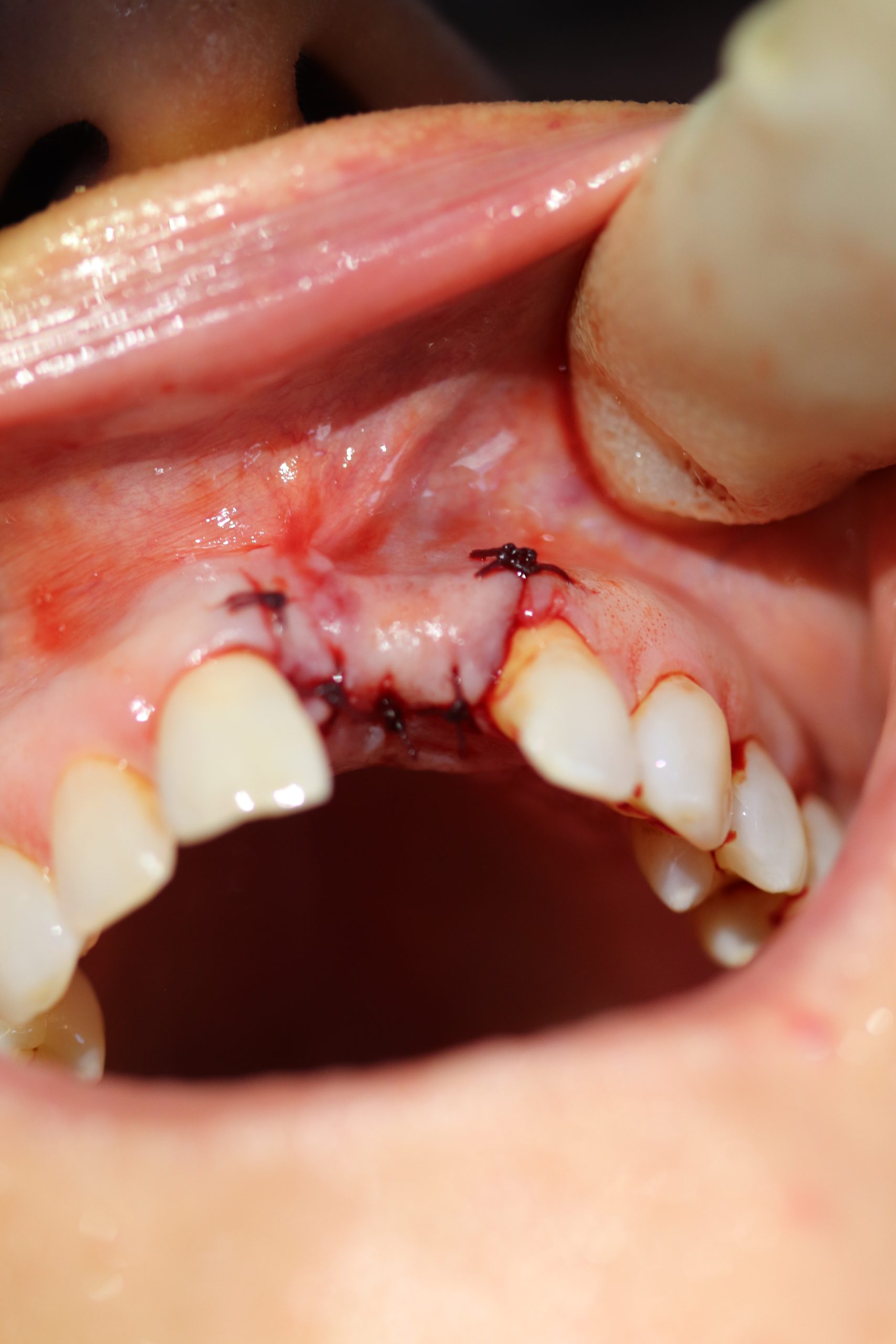 After -Abacus Dental